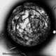 An unprocessed transmission electron microscope image of a gas core surrounded by a bio-compatible shell. By Estelle Beguin - University of Oxford (Image: EPSRC)